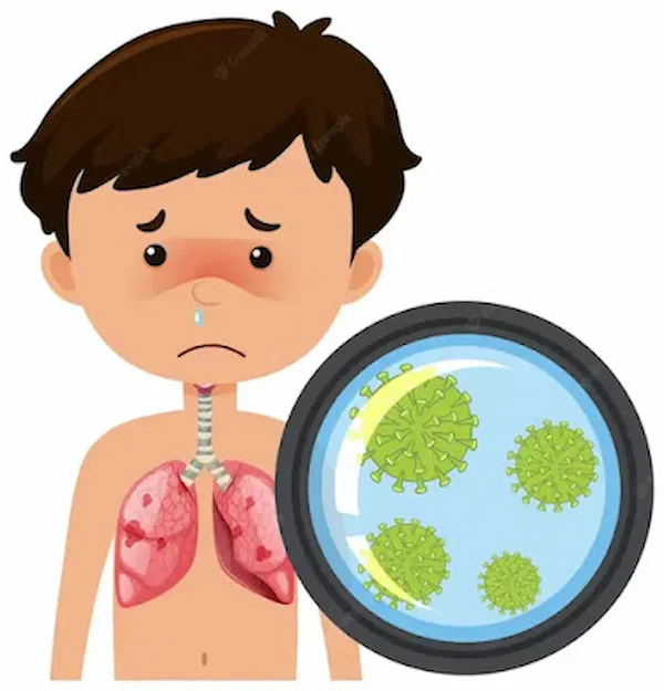 أمراض الجهاز التنفسي عند الأطفال